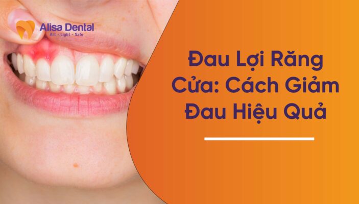 Đau Lợi Răng Cửa: Cách Giảm Đau Hiệu Quả