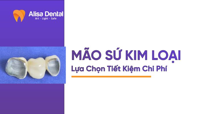 Mão Sứ Kim Loại: Lựa Chọn Tiết Kiệm Chi Phí