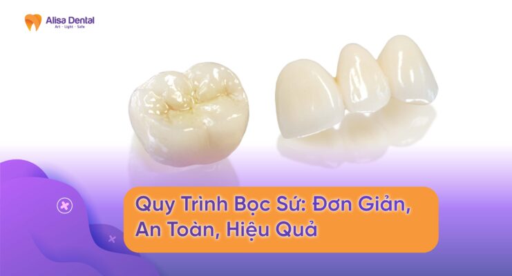 Quy Trình Bọc Sứ: Đơn Giản, An Toàn, Hiệu Quả