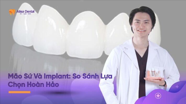 Mão Sứ Và Implant: So Sánh Lựa Chọn Hoàn Hảo