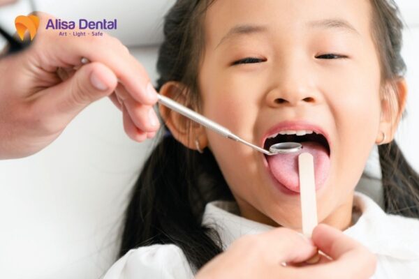 Các phương pháp điều trị sâu răng cho trẻ