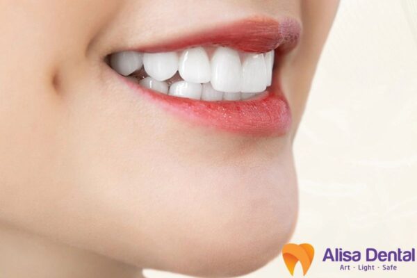 Bọc răng sứ chữa sâu răng nhanh 