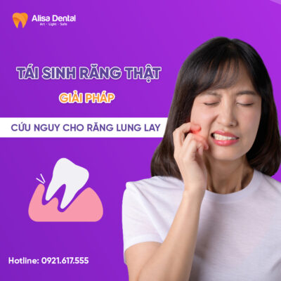 Tái sinh răng thật, cứu nguy cho răng lung lay