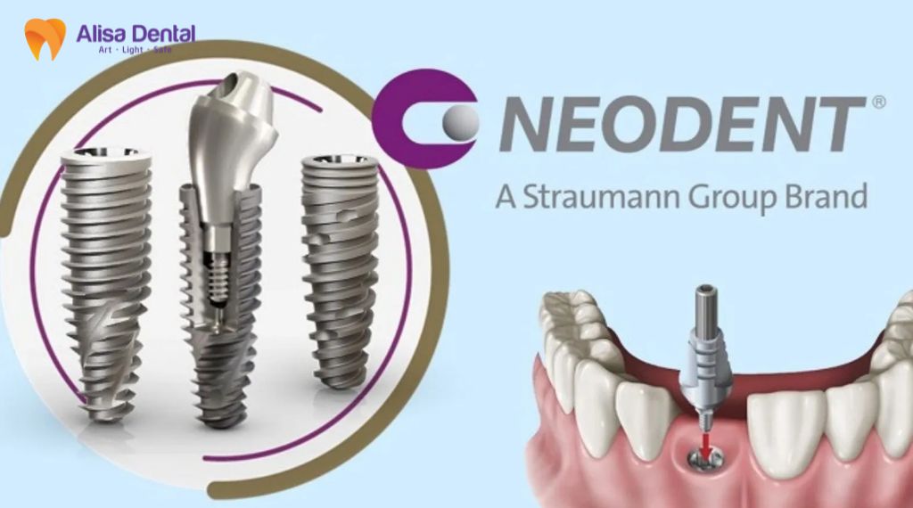 implant straumann là gì
