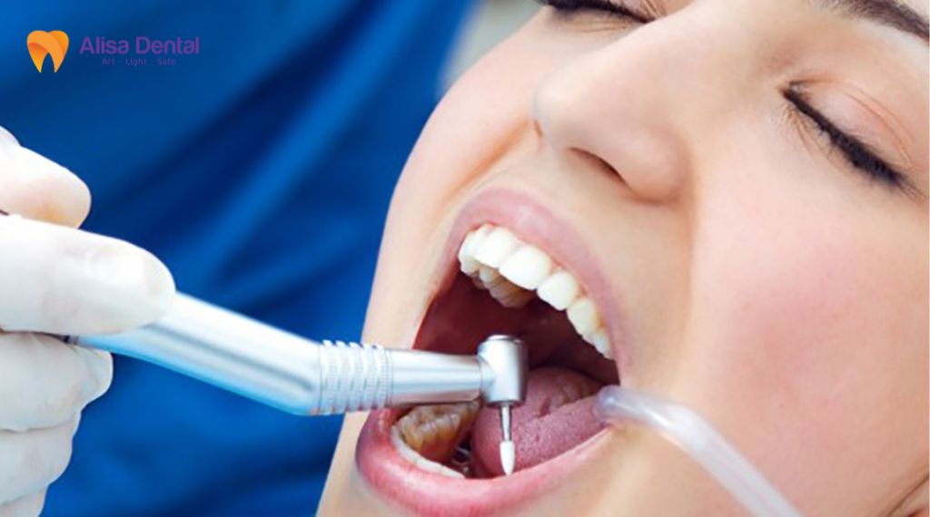 Điều trị tủy răng