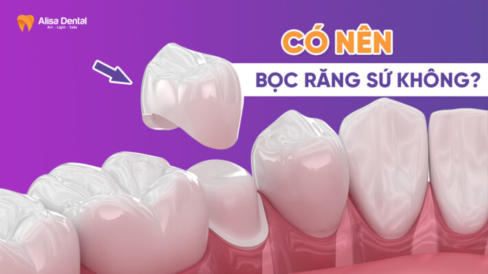Có nên bọc răng sứ không