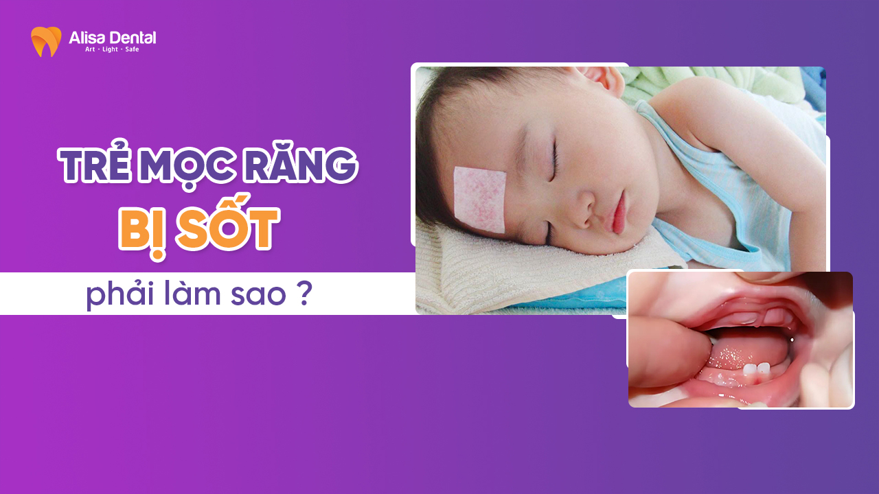 Trẻ mọc răng bị sốt phải làm sao