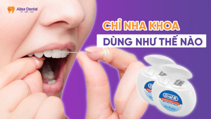 Chỉ nha khoa dùng như thế nào