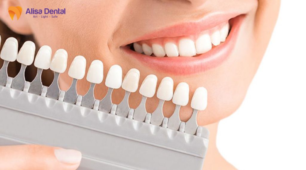 Bọc răng sứ cho răng xỉn màu