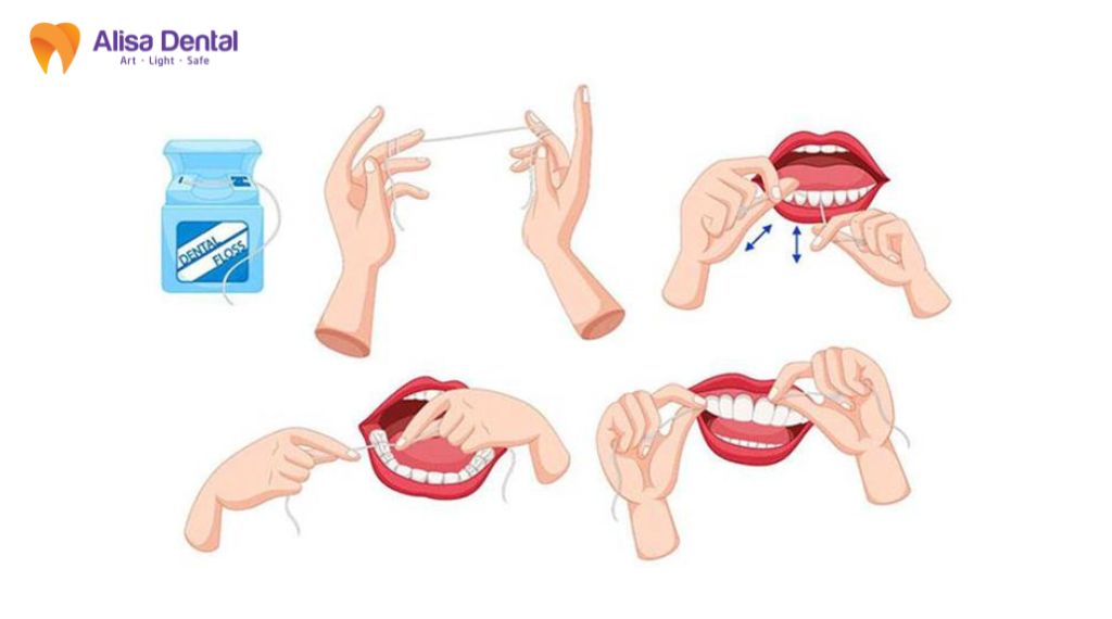 Chỉ nha khoa dùng như thế nào