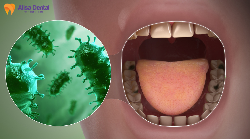 chua-hoi-mieng-don-gian