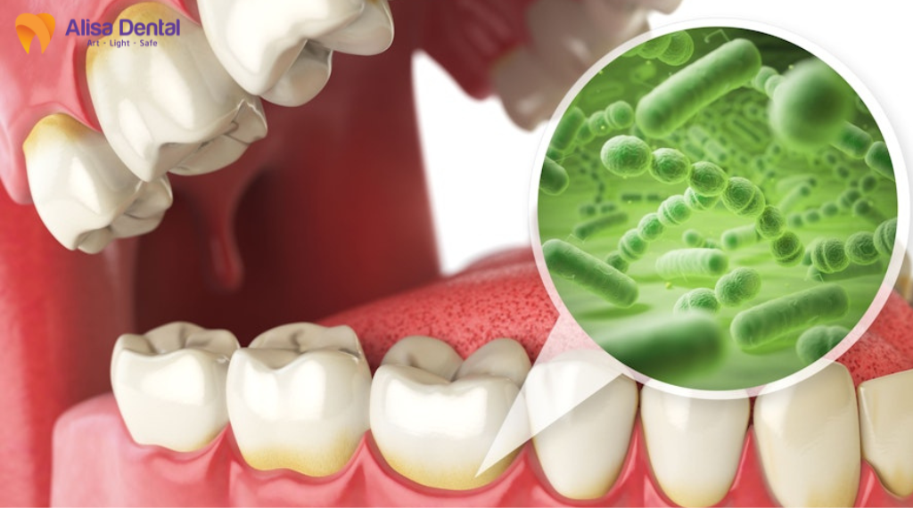 chua-hoi-mieng-don-gian