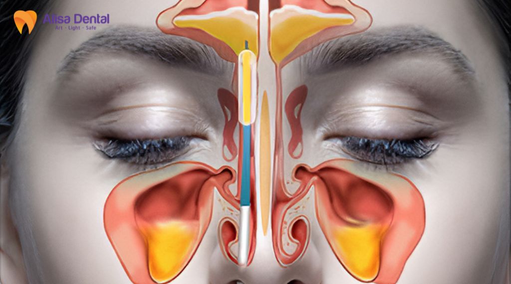 Đau một bên hàm