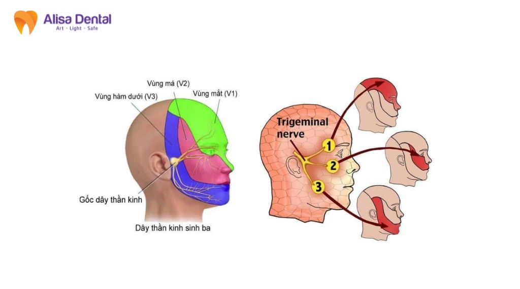 Đau một bên hàm