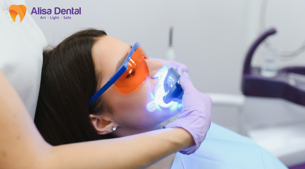 phuong-phap-tay-trang-rang-hien-nay