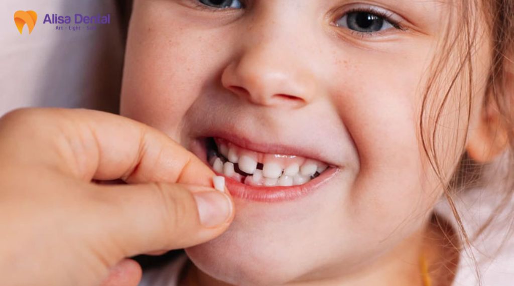 Trẻ em mấy tuổi thay răng