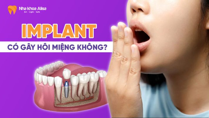 implant-co-gay-hoi-mieng-khong