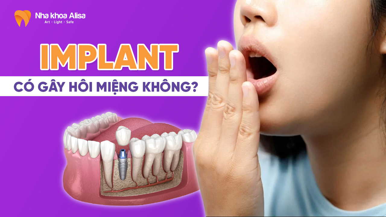implant-co-gay-hoi-mieng-khong