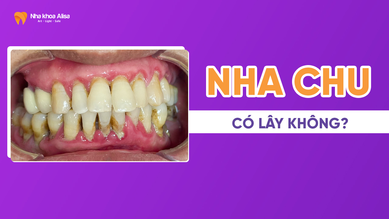 nha-chu-co-lay-khong