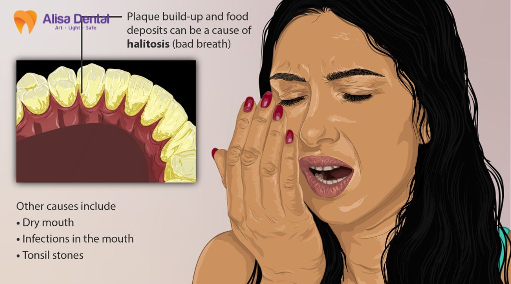 Bad Breath