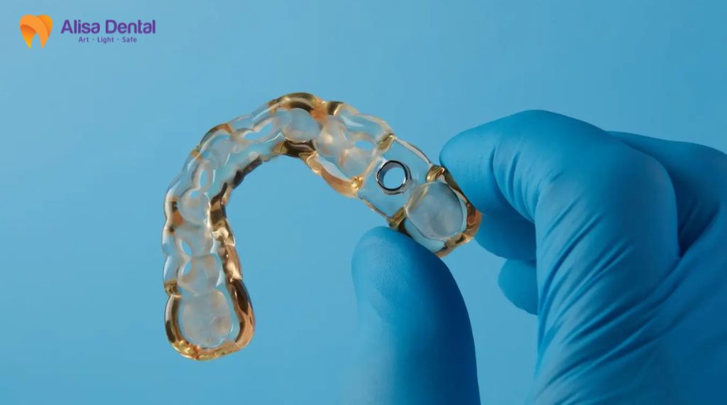 Alisa - Best Dental clinic for expat in Hanoi