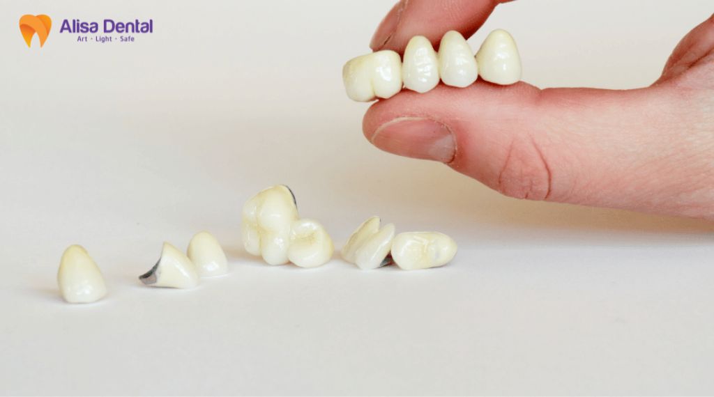 dental implant cost Hanoi