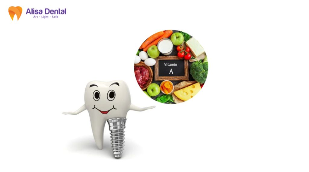 Ghép xương trong trồng răng implant là gì