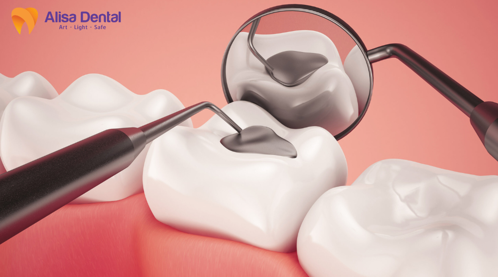 me-rang-do-can-vao-vat-cung