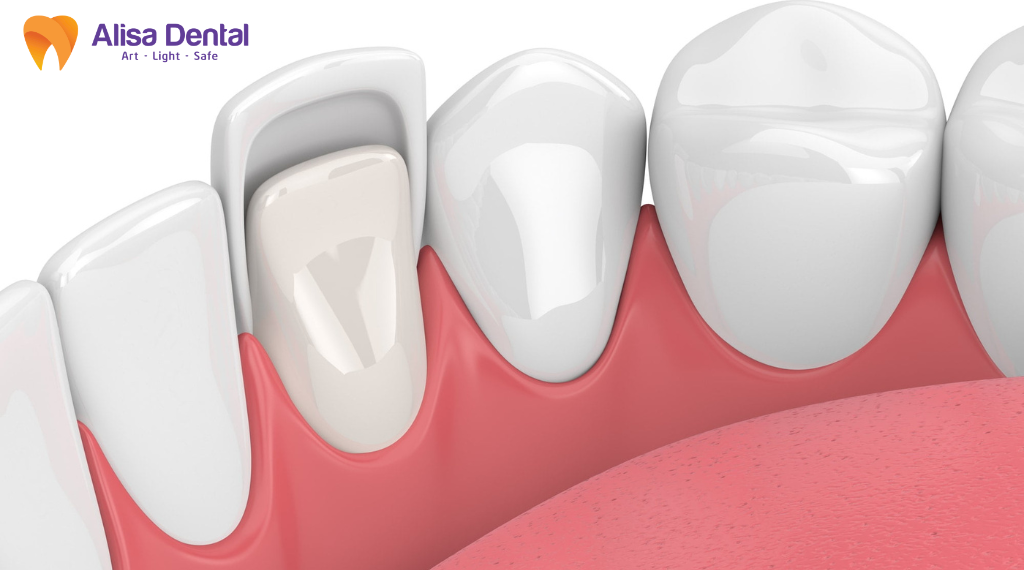 me-rang-do-can-vao-vat-cung