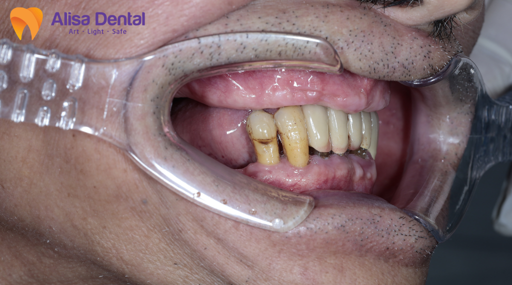 nha-chu-co-lay-khong