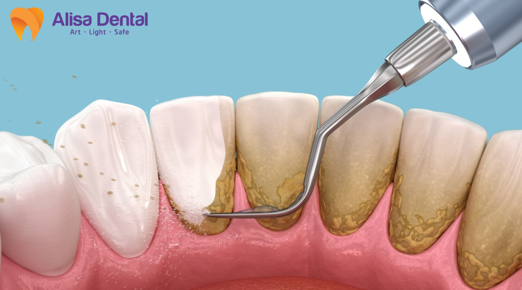 nha-chu-co-lay-khong
