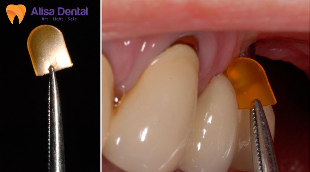nha-chu-co-lay-khong