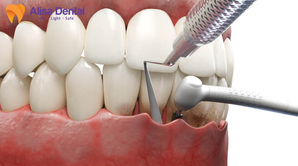 nha-chu-co-lay-khong