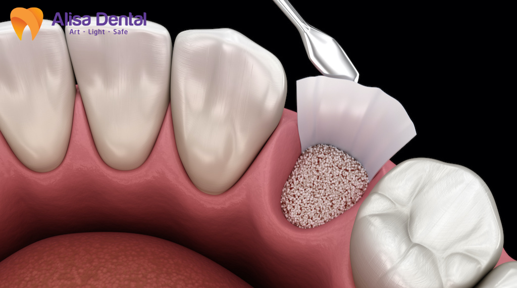 nha-chu-co-lay-khong