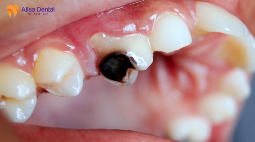 Tootach - What should you do?