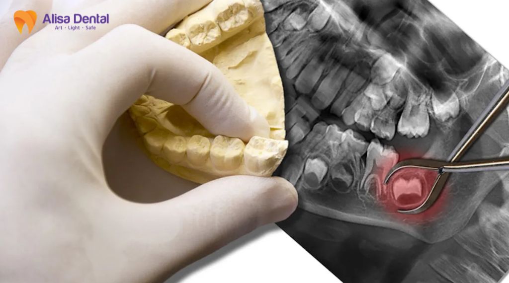 Tootach - What should you do?