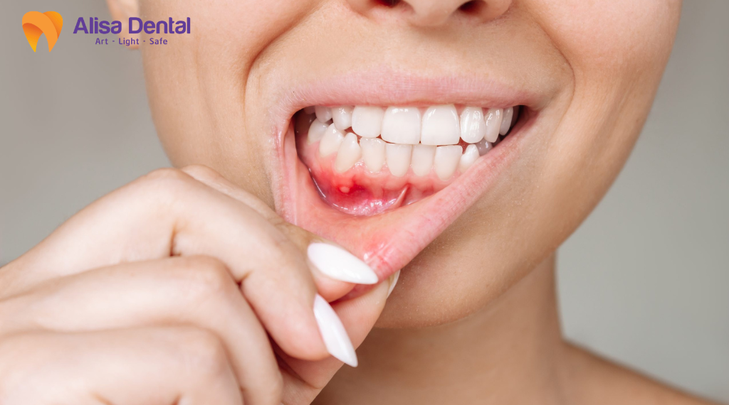 top-5-benh-ly-pho-bien-ve-rang